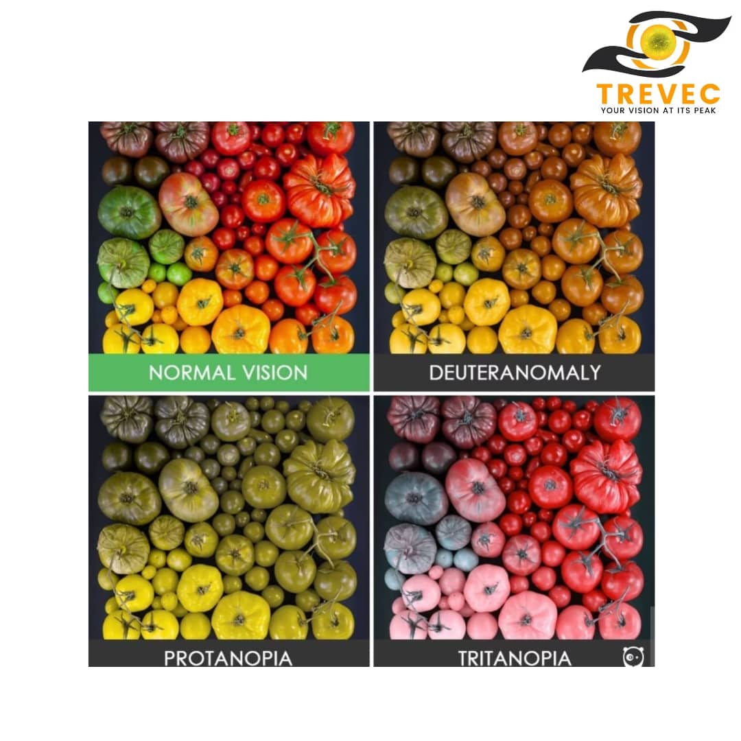 Types of color blindness deficiency